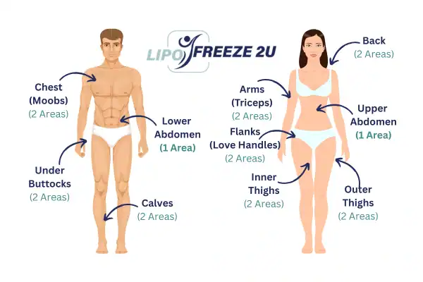 Areas you can have fat freezing treatment Thatcham