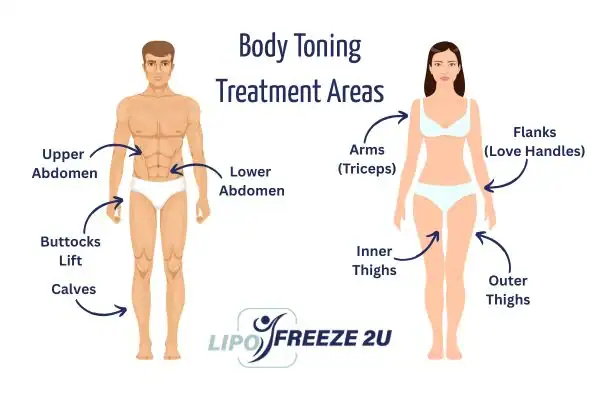 Graphic showing where you can have Body toning Treatment Thatcham on your body