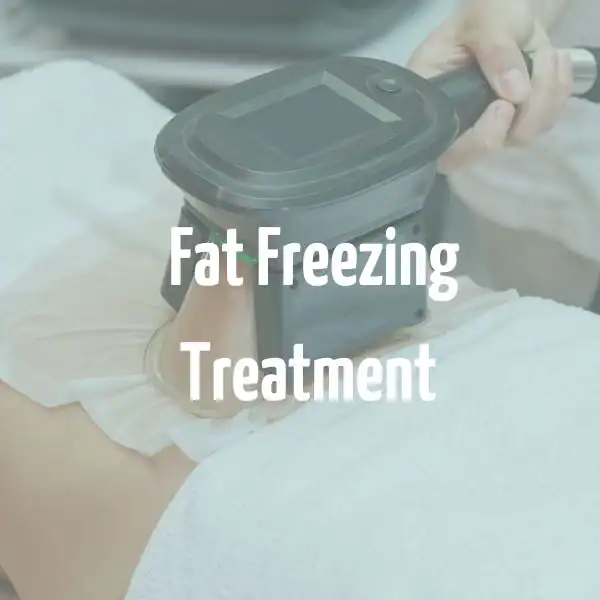 fat freezing treatment Thatcham