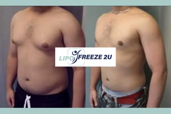 How Long Does It Take to See Results Thatcham?
