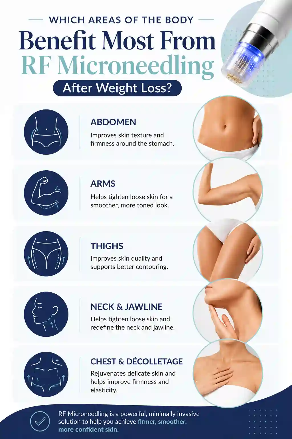 Which Areas of the Body Benefit Most From RF Microneedling After Weight Loss Thatcham